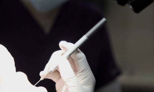 Minimally invasive hair transplantation with less scalp damage