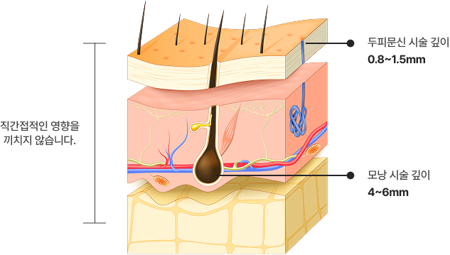 Won't the procedure damage my scalp and hair follicles?