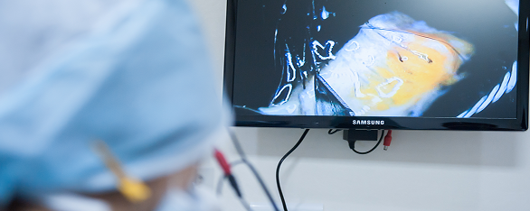 Transplanting Fine Hair