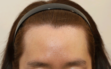 얼굴형, 헤어라인에 구애 없이 완성하는 맞춤형 라인