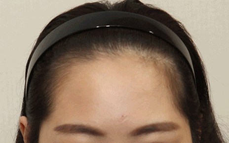 얼굴형, 헤어라인에 구애 없이 완성하는 맞춤형 라인