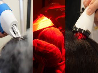 Personalized mechanical treatment